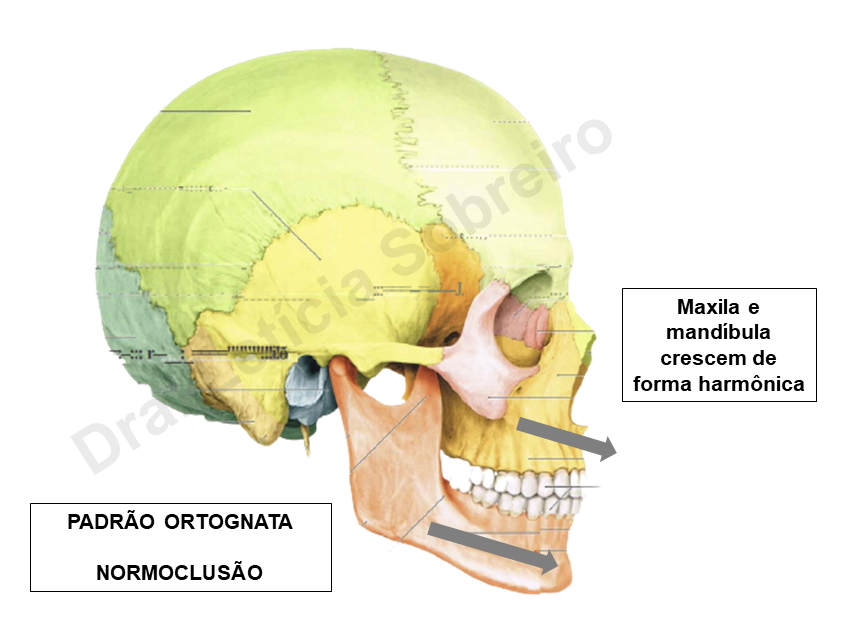 A. Maxila e mandíbula em oclusão frontal inicial, mostrando a